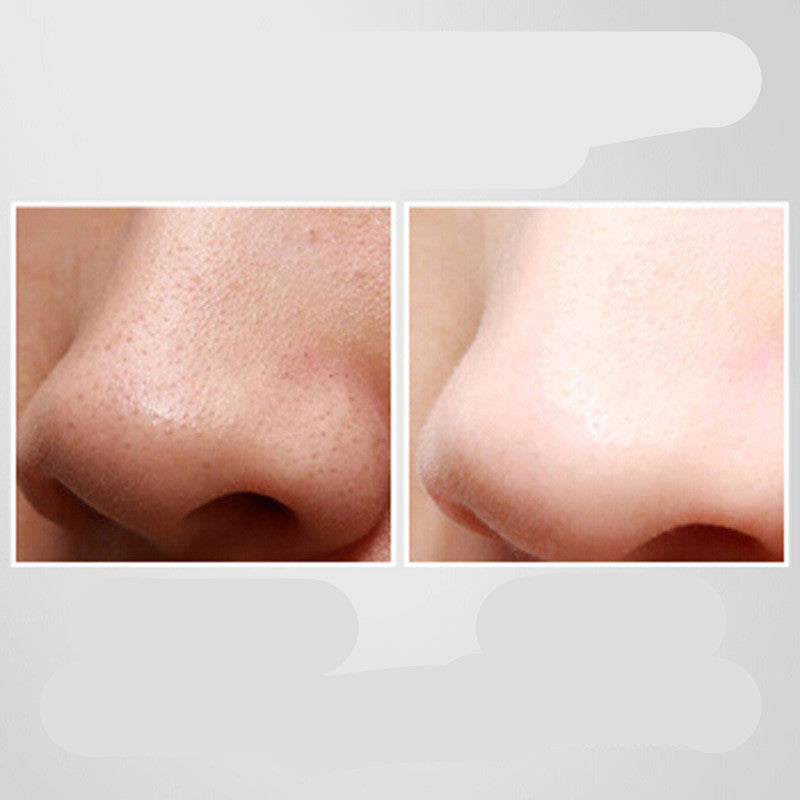 Ultrasonic pore cleaner